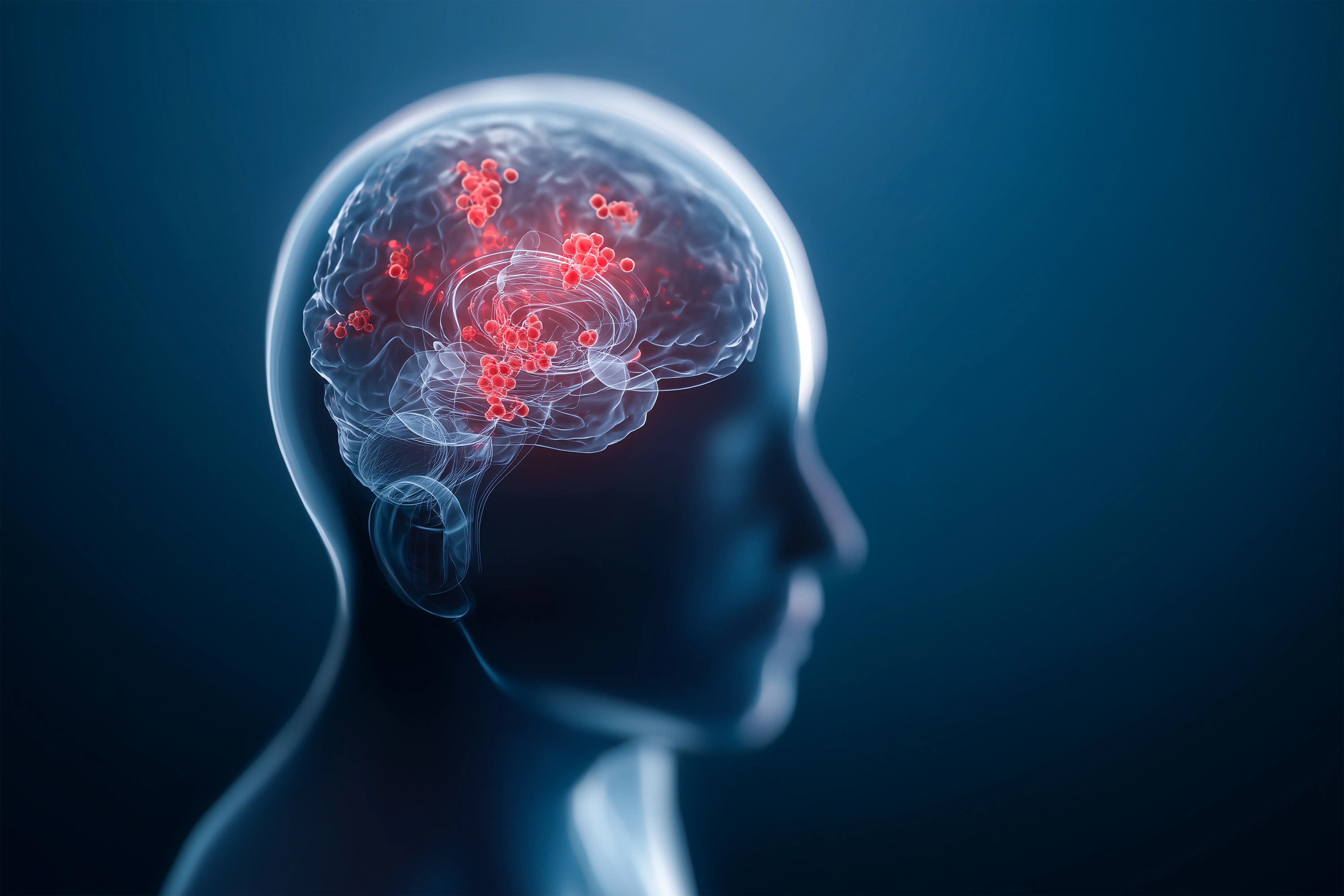 What Leads To Signs Of Acute Encephalitis Syndrome And Diagnosis